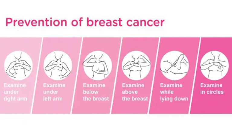 Prevent-Breast-Cancer