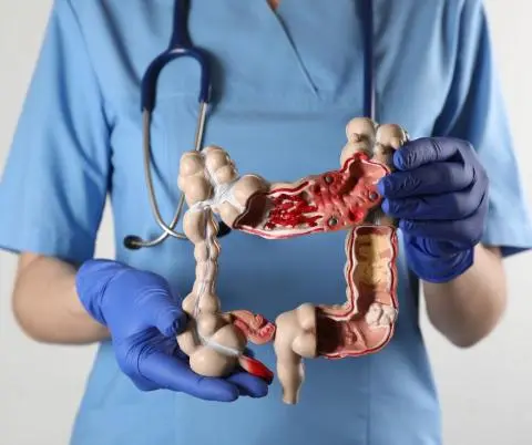 Colorectal Cancer Treatment in Kolkata - Dr. Sandip Ganguly