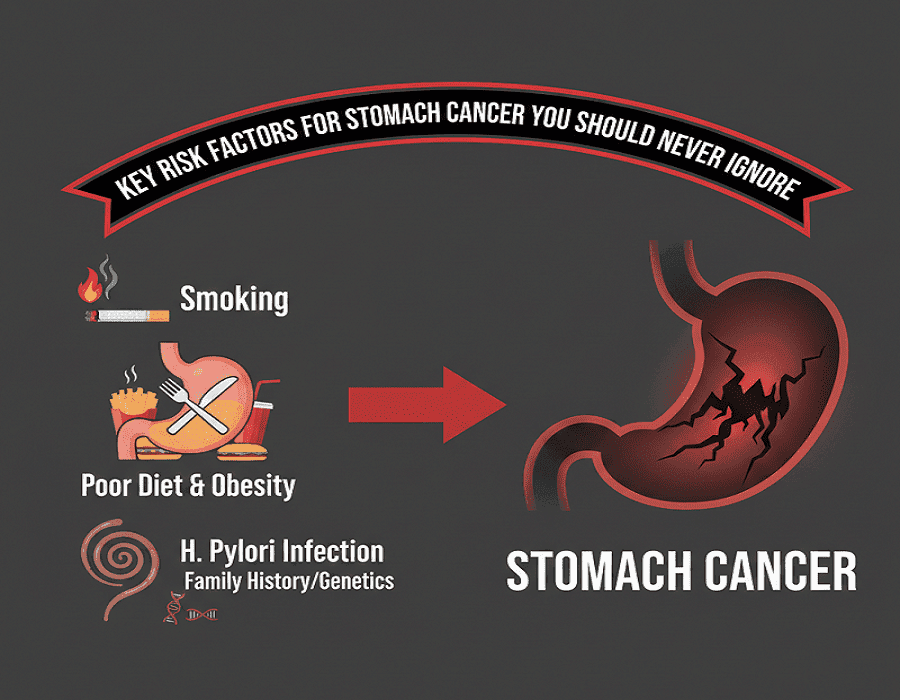 Key Risk Factors for Stomach Cancer