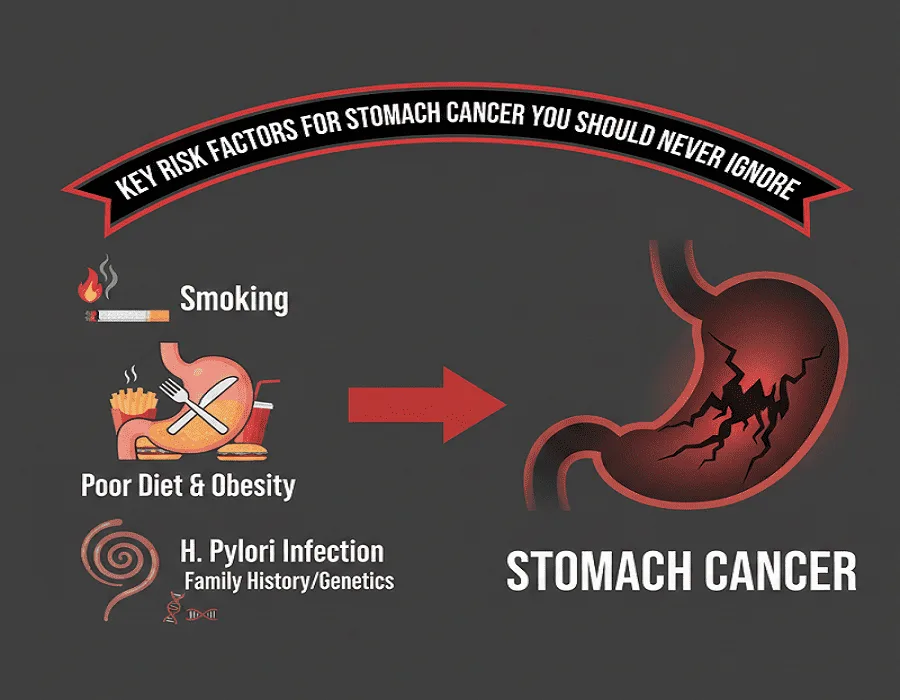 Key Risk Factors for Stomach Cancer