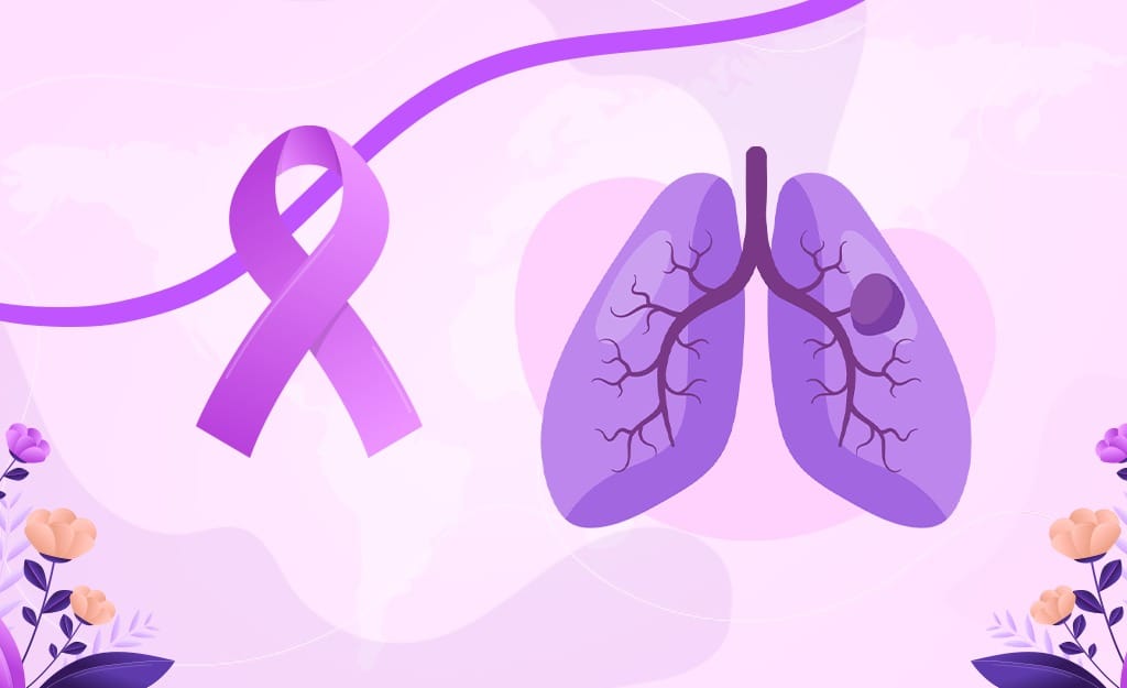 Causes of Lung Cancer