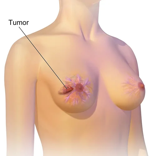 1female-breast-word-contemplative-is-shown-bottom